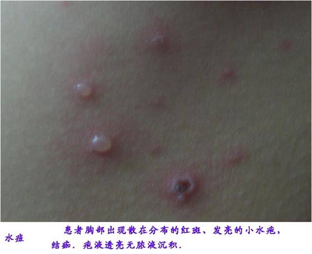 СˮǰʲôӣСӳˮʲôY[DƬ]-2
